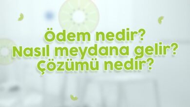 Ödem Nedir, Nasıl Meydana Gelir ve Çözümü Nedir?