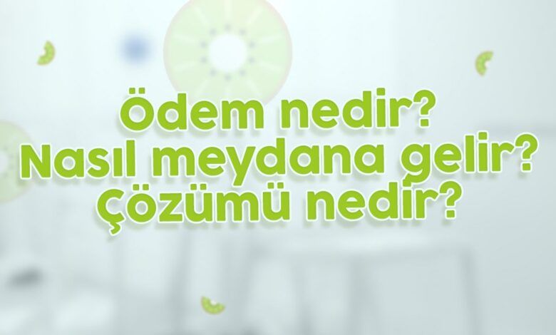 Ödem Nedir, Nasıl Meydana Gelir ve Çözümü Nedir?