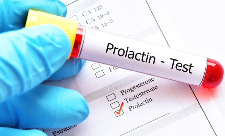 Prolaktin (Süt Hormonu) Nedir?